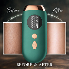 SilkBeam IPL Hair Removal